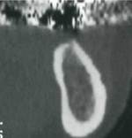 тип 3
