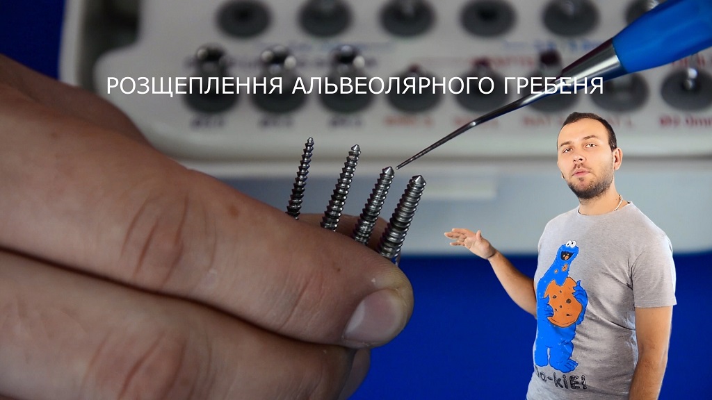 Розщеплення альвеолярного гребеня