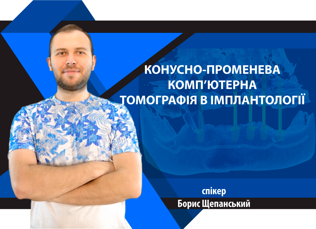 Конусно-променева компю’терна томографія в імплантології вебінар