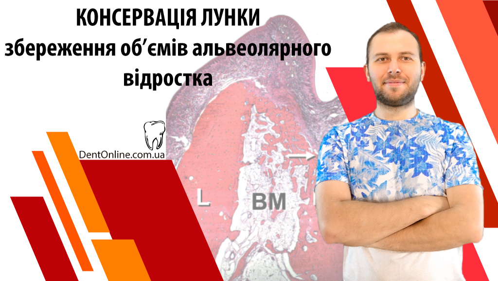 консервація лунки семінар