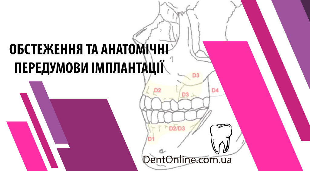 курс по імплантології обстеження та анатомія