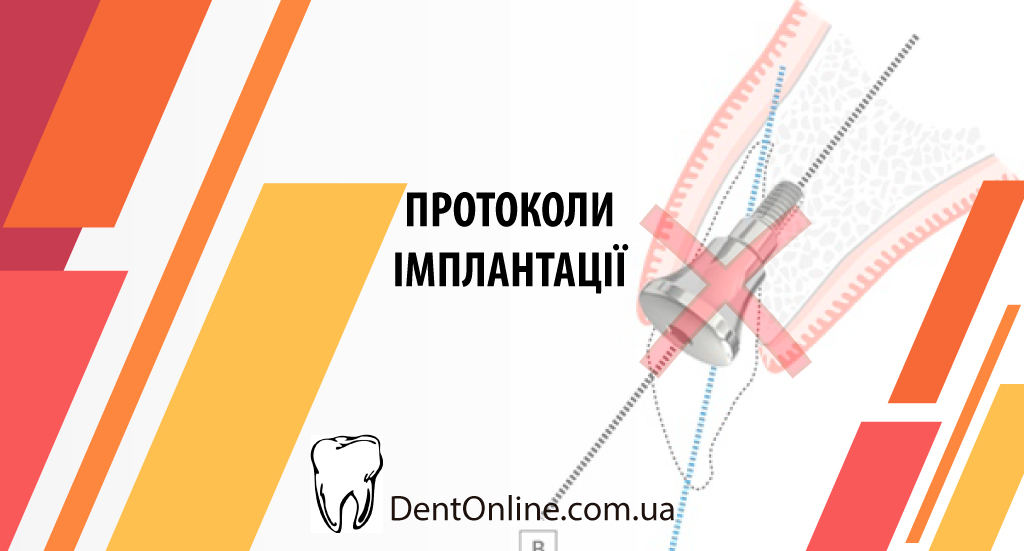 курс по імплантології протоколи імплантації