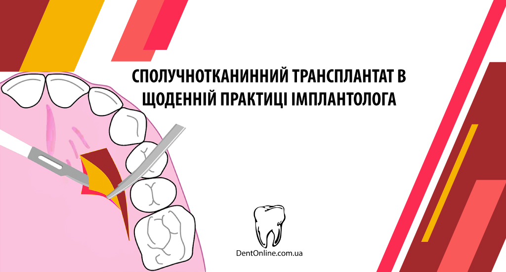 майстерклас сполучнотканинний трансплантат