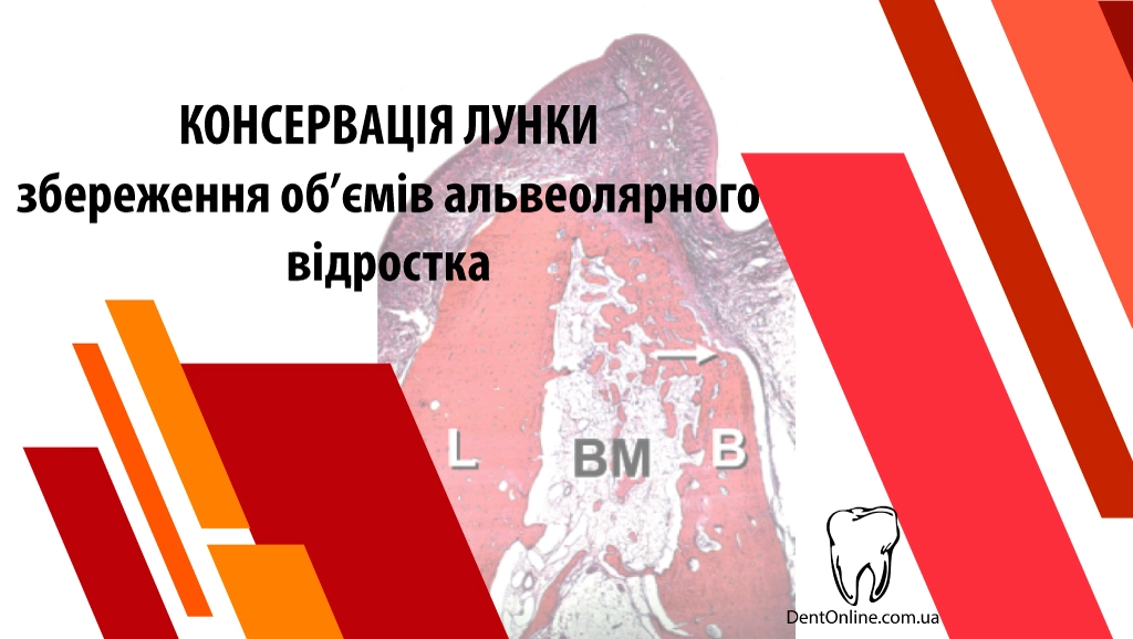семінар консервація лунки
